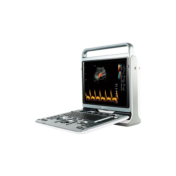 Pantalla del ultrasonido Chison EBit 50 mostrando imágenes ecográficas en alta definición