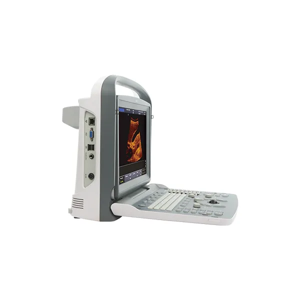 Panel de control y teclas funcionales del ultrasonido Chison ECO2