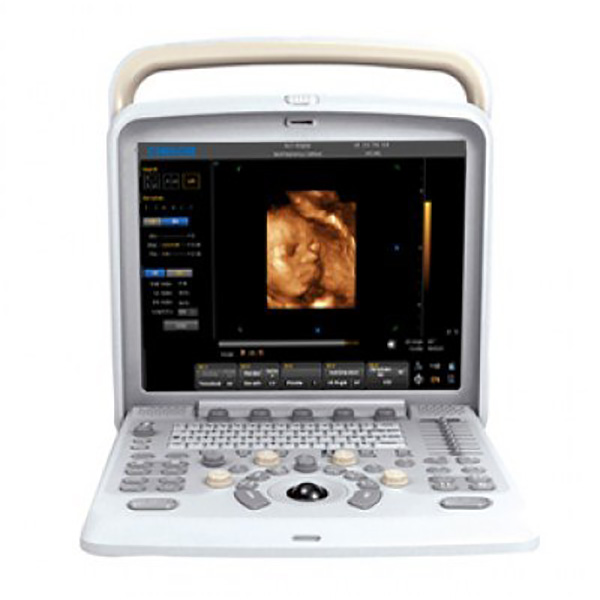 Ultrasonido Chison Q5