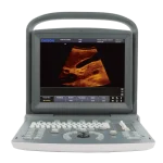 Ultrasonido Chison Eco2