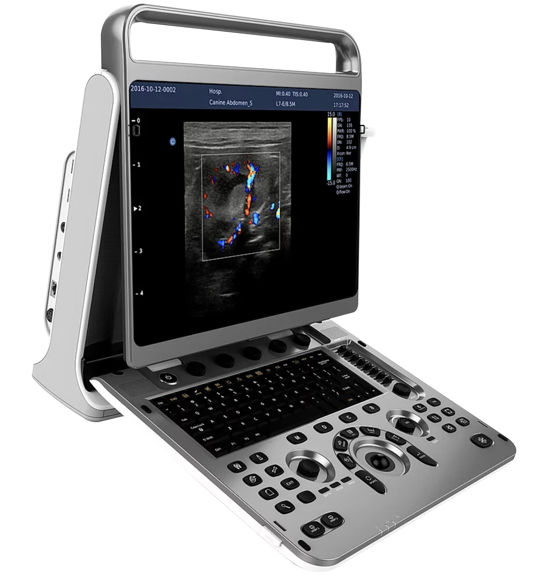 ECÓGRAFO PORTÁTIL EBIT 30