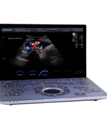 Vista general del ultrasonido portátil Sonoair-60 con diseño ligero y moderno