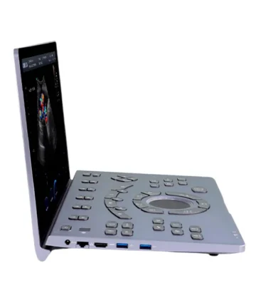 Pantalla del ultrasonido portátil Sonoair-60 con visualización de imágenes diagnósticas de alta resolución