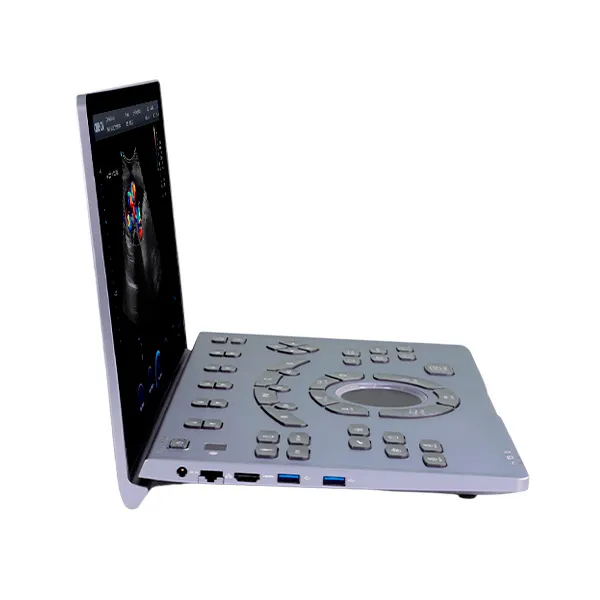 Pantalla del ultrasonido portátil Sonoair-60 con visualización de imágenes diagnósticas de alta resolución