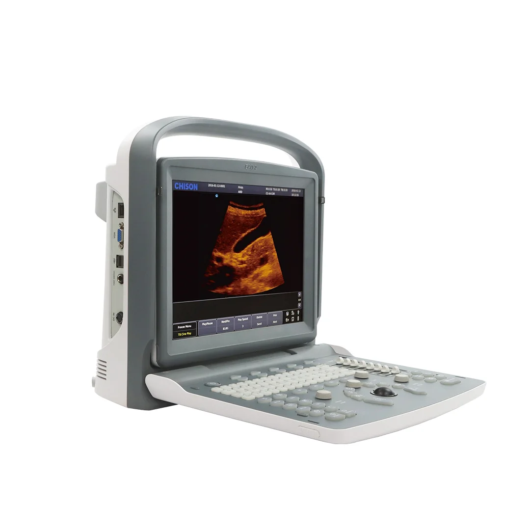 Ultrasonido Portátil de Alta Precisión ECO 2+ - Imagen 2