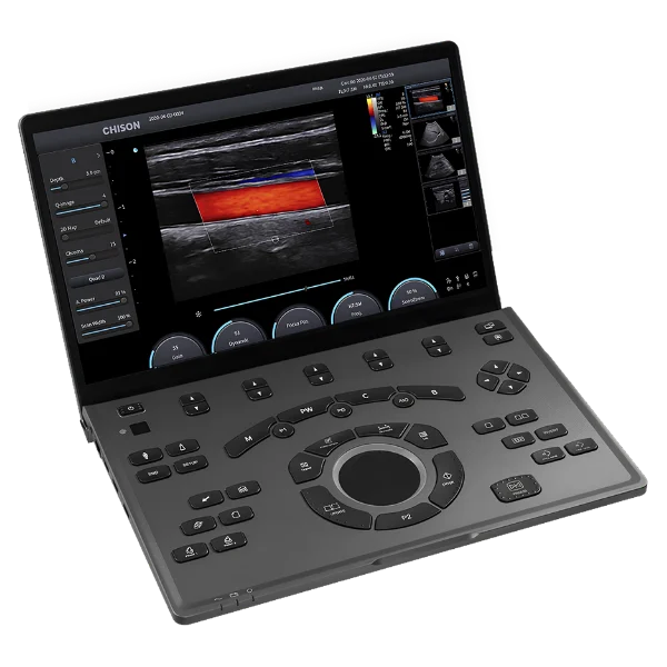 Ultrasonido Portátil Sonoair-30 - Imagen 3