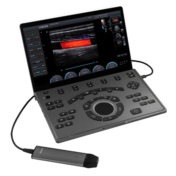 Ultrasonido Portátil Sonoair-30 - Imagen 5