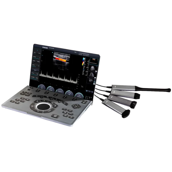 Ultrasonido Portátil Sonoair-30 - Imagen 6
