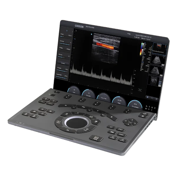 Ultrasonido Portátil Sonoair-30