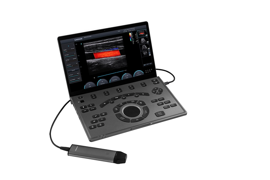 Ultrasonidos Zegen