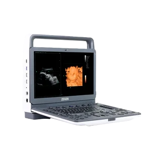 Ultrasonidos