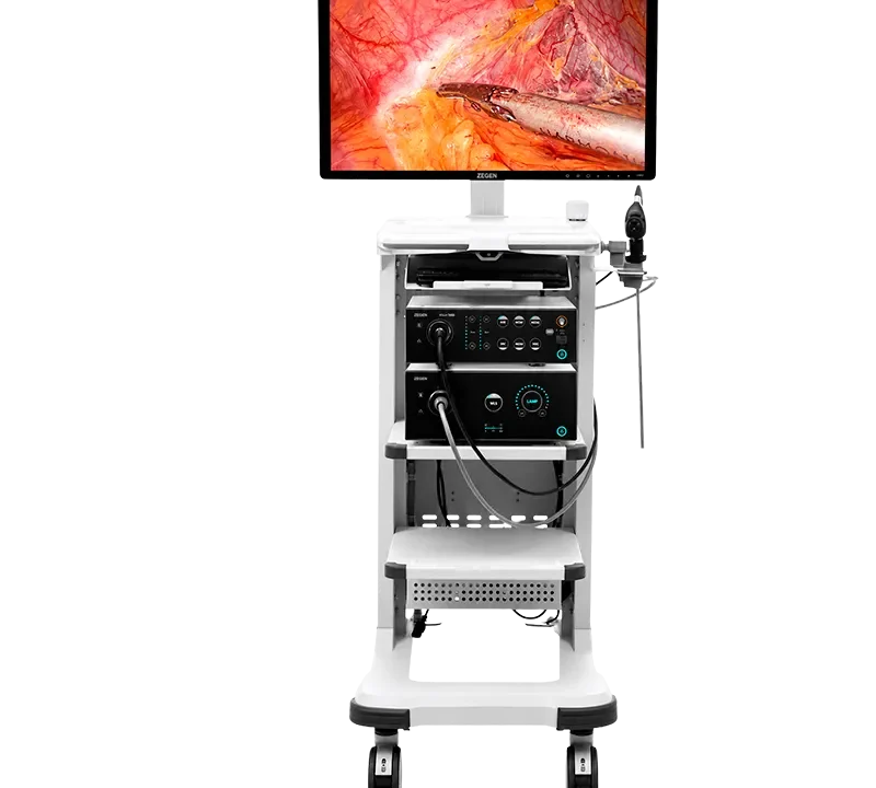Laparoscopia